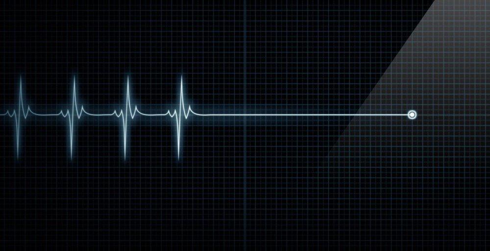 A cardiogram graph showing a flatline.