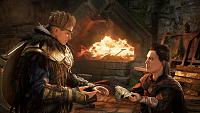 Click image for larger version

Name:	ACV_DOR_ReceivingBracer.jpg
Views:	265
Size:	588.4 KB
ID:	3515128