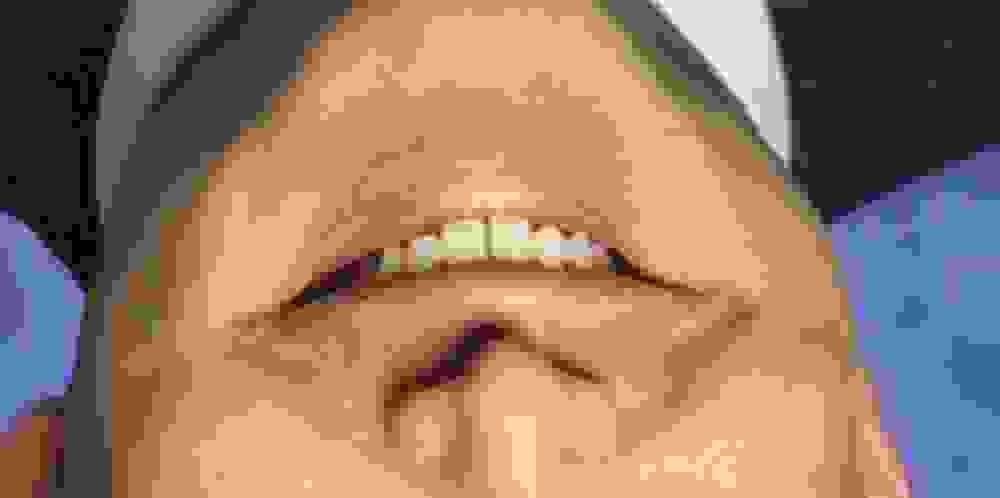 Flipped image of the bottom half of a face. It shows a smiling mouth and part of a nose.